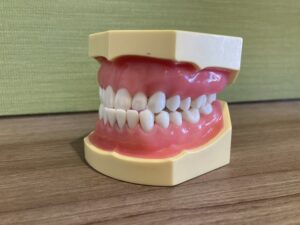 不正咬合　矯正　受け口　出っ歯